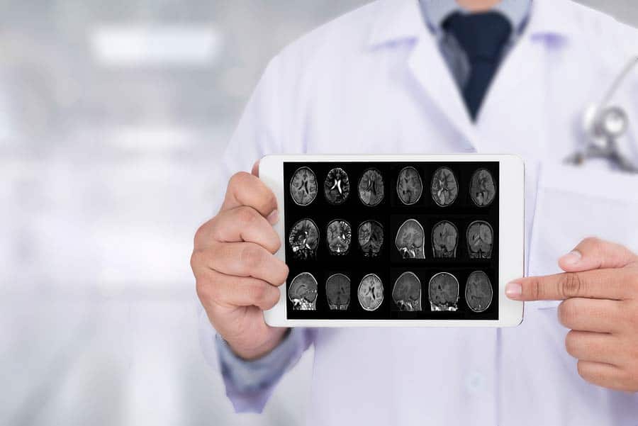 Lékař ukazující obrázky mozku, který postihla Alzheimerova choroba
