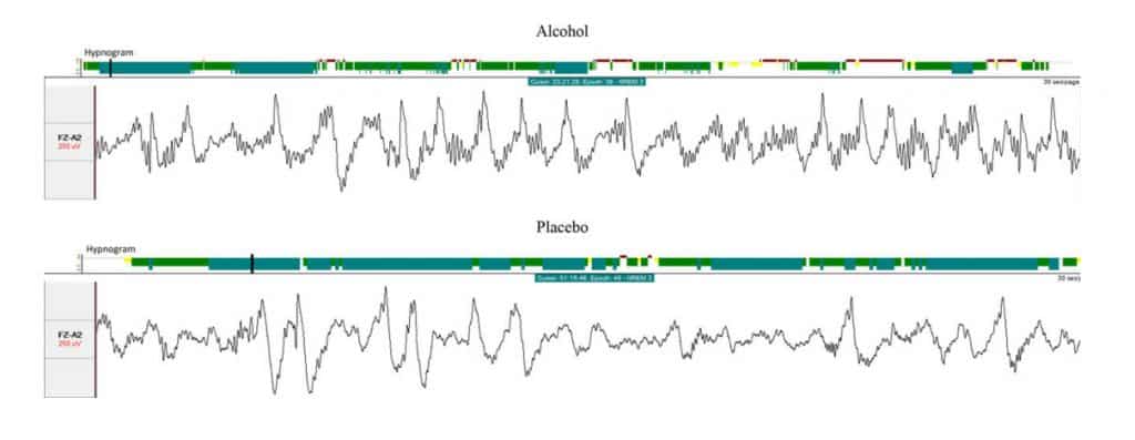 Záznam eeg mozku během spánku pod vlivem alkoholu a placeba