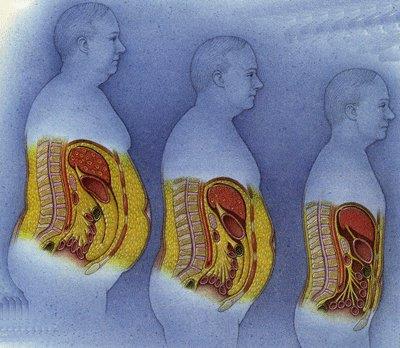 3 postavy různé tloušťky a znázornění ukládání tuku na vnitřních orgánech