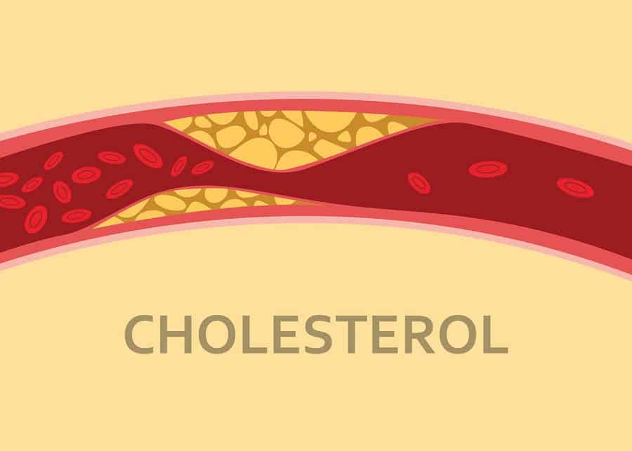Vysoky cholesterol